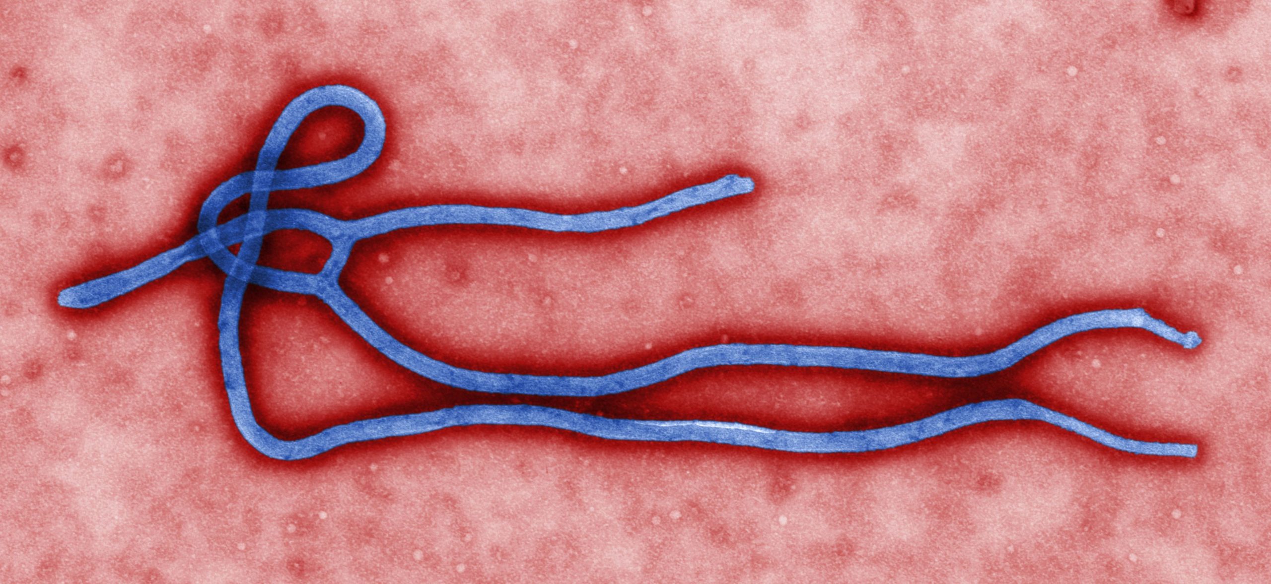 Ebola & LEOs